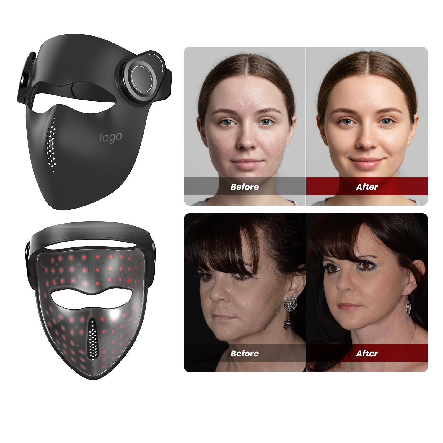 LED Light Therapy Beauty Mask
